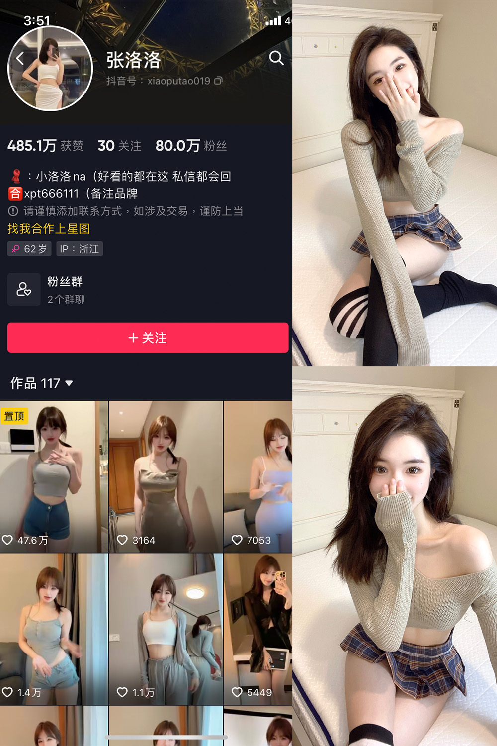 抖音 张洛洛 微密圈 NO.002期 【27P】-雪莲